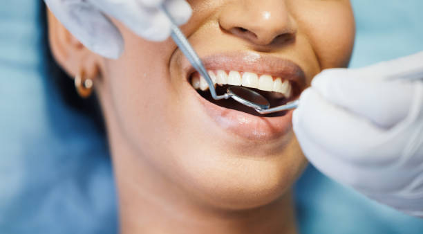 Best Root Canal Treatment  in Hwatha, IA